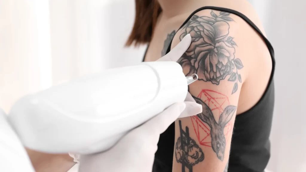 Safely remove tattoos